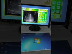 Feste Wellenquelle außerkörperliche Stoßwelle Lithotripsy-Maschine Ultraschall-Lokalisierungssystem