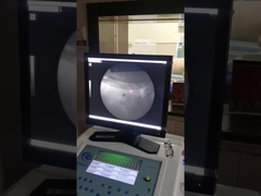 Hochgenaue außerkörperliche Stoßwellenmaschine, Shockvave Lithoripsi-Röntgensystem.